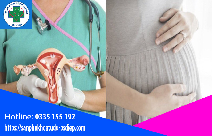 cach-duong-thai-khi-bi-u-xo-tu-cung Cách dưỡng thai khi mang thai có u xơ tử cung