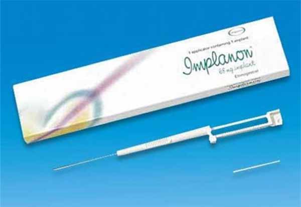 cay-que-ngua-thai Cấy que ngừa thai