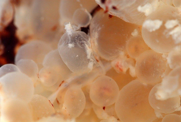 Chửa trứng bán phần