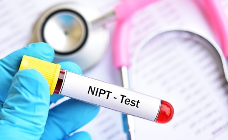 co-nen-xet-nghiem-nipt Xét nghiệm NIPT