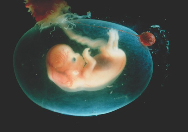 Đa ối có nên mổ sớm không còn phụ thuộc vào nhiều yếu tố