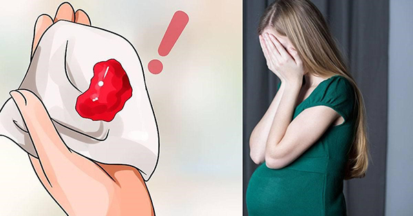 Dấu hiệu sảy thai hai tuần đầu