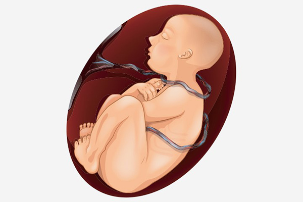 Dây rốn dài hơn bình thường