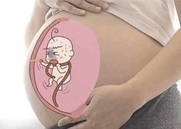 Dây rốn quấn cổ quá chặt