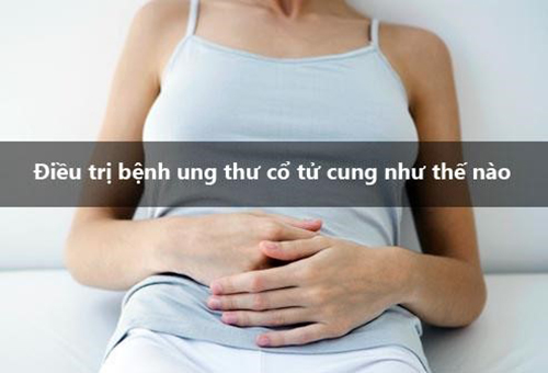 Điều trị ungg thư cổ tử cung
