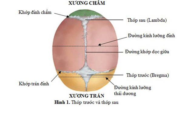 Đường kính lưỡng đỉnh