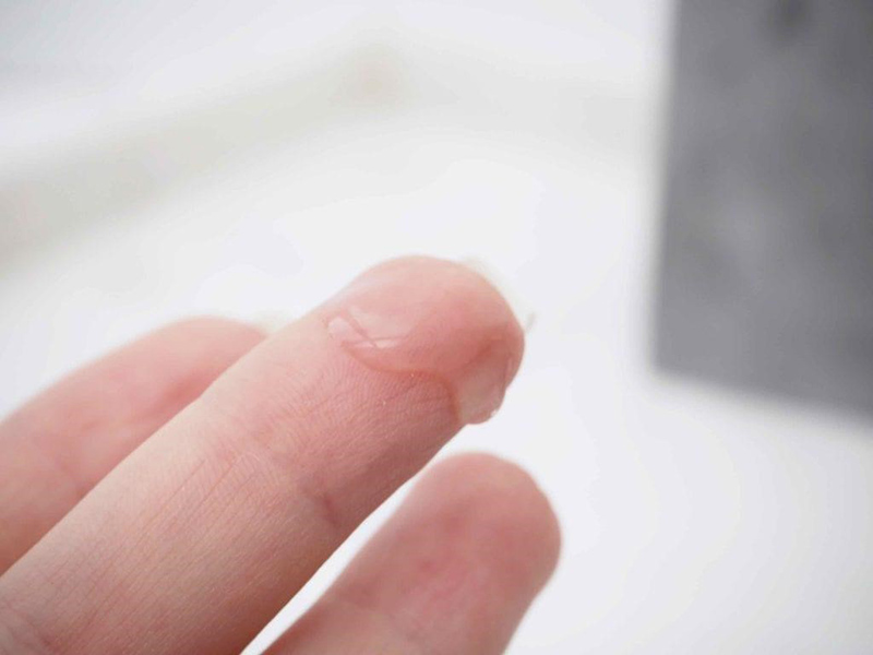 Huyết trắng đặc