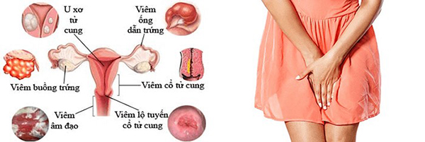 kham-phu-khoa-nen-luu-y-dieu-gi Khám phụ khoa nên lưu ý điều gì?