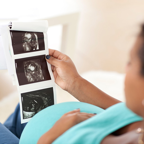 kham-thai-tuan-161 Khám thai tuần 16 là cột mốc đáng nhớ của mẹ