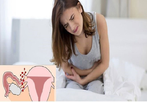 kho-chiu-khi-di-ve-sinh Khó chịu khi đi vệ sinh