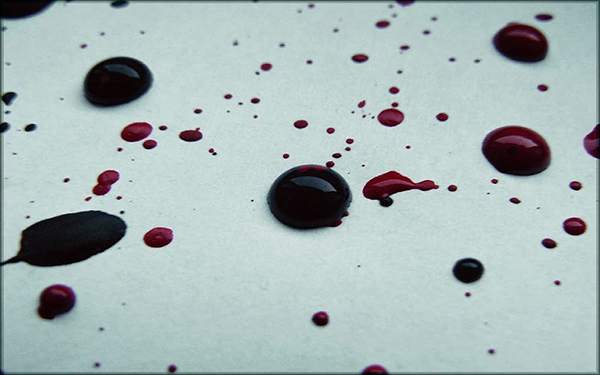 Kinh nguyệt màu đe