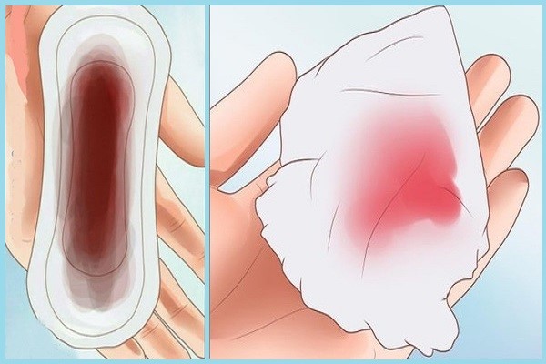 Kinh nguyệt ra nhiều