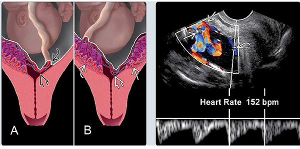 Mạch máu tiền đạo