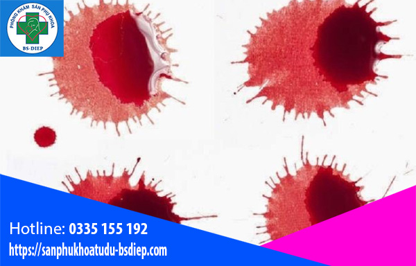 Máu báo thai là một trong những dấu hiệu để chị em nhận biết mình mang thai hay không