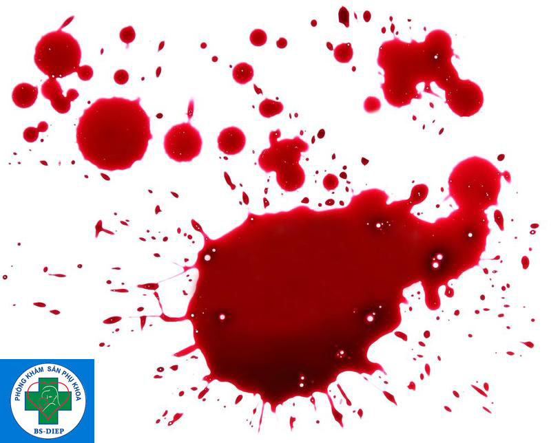 mau-xay-thai-co-mau-gi-2 Máu xảy thai có màu gì