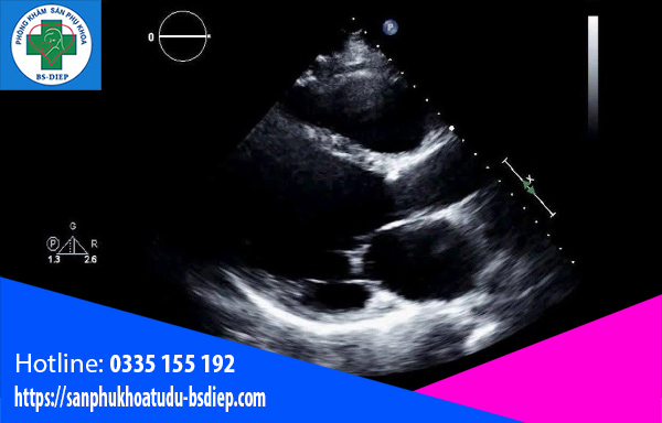 Mây tuần có tim thai
