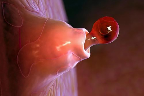 Ngày rụng trứng là ngày nào