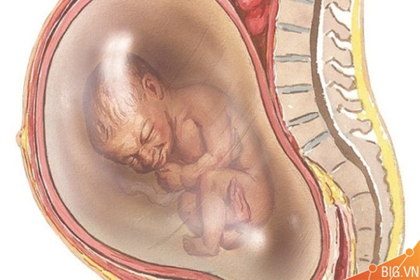 Thai nhi không quay đầu gây khó dễ cho việc sinh đẻ của mẹ và sức khoẻ của bé.