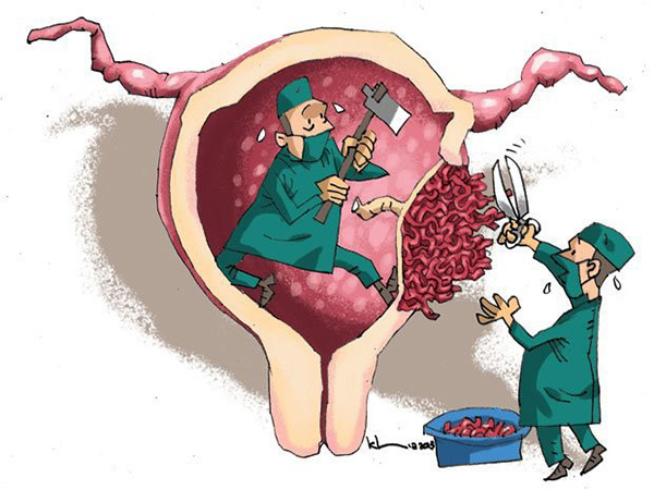 Nhau cài ăng lược