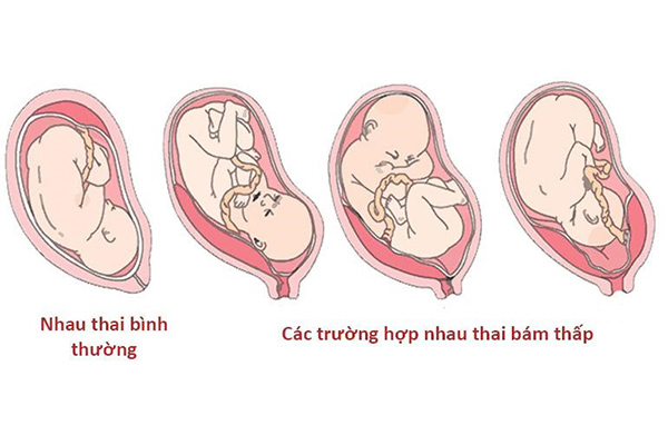 Rau bám thấp