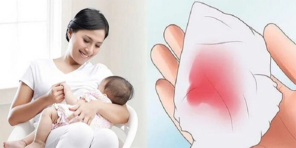 sau-sinh-mo-bao-lau-thi-co-kinh-lai Sau sinh mổ bao lâu thì có kinh lại