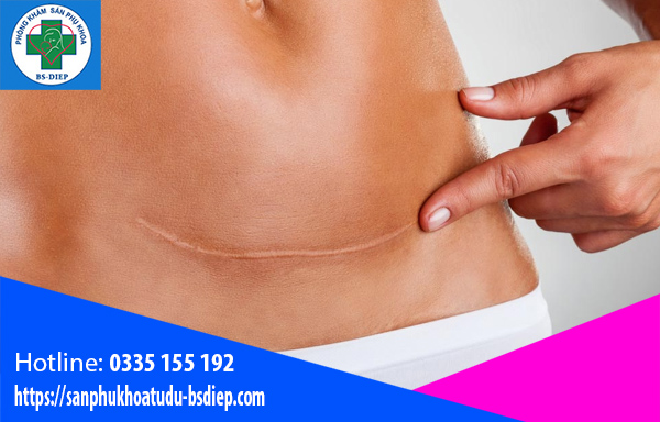 Sau sinh mổ quan hệ sớm bị nhiễm trùng