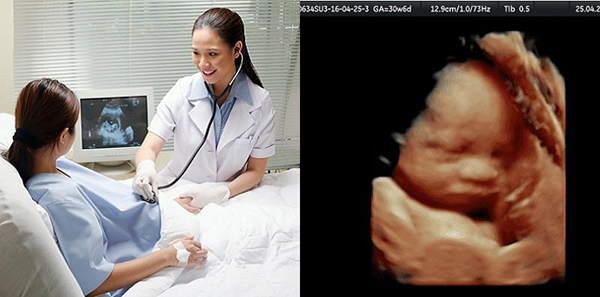 tang-lich-kham-thai Tăng lịch khám thai