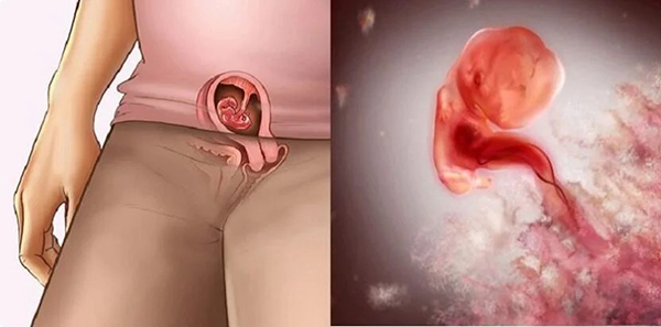 Thai 5 tuần đã có tim thai chưa