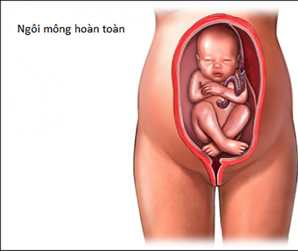 Thai ngôi mông toàn thân