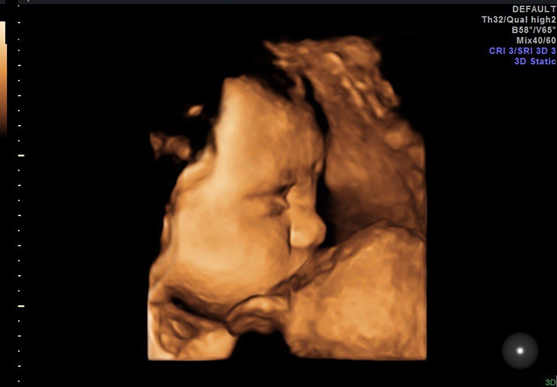 thai-phat-trien-tuan-32 Thai phát triển tuần 32