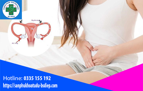 that-ong-dan-trung-ga-tac-dung-phu Thắt ống dẫn trứng gây tác dụng phụ