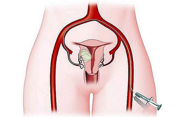 tiem-thuoc Bạn có thể đẩy lùi bệnh thông qua việc tiêm thuốc