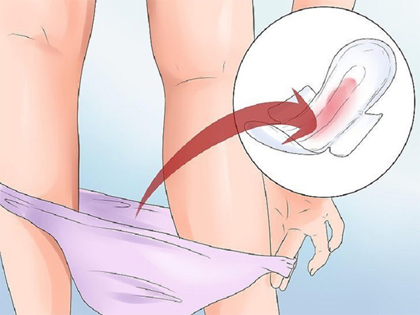 Triệu chứng tăng sinh mạc tử cung