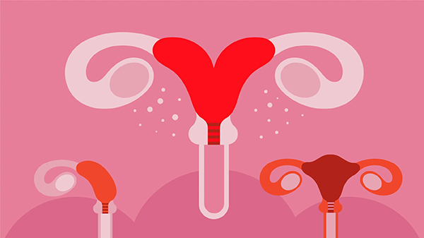 Tử ung bất thường