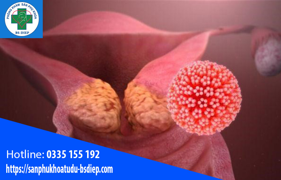 Ung thư cổ tử cung