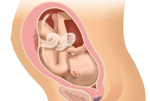 Vị trí ngôi thai đầu