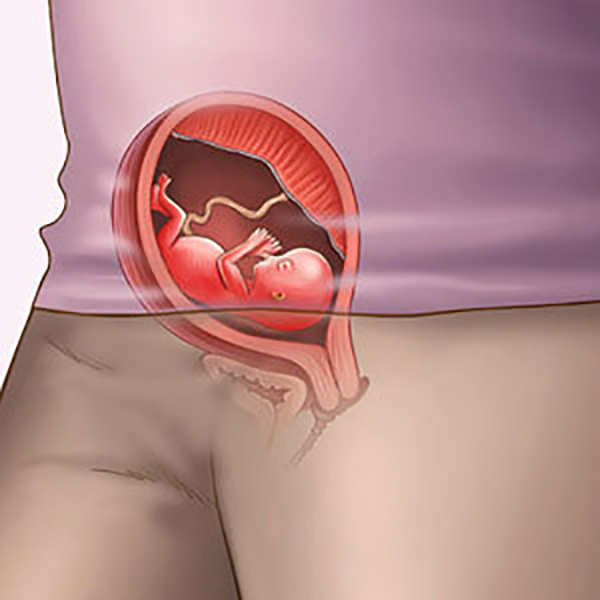 Vị trí thai nhi trong bụng mẹ 3 tháng đầu không ngừng thay đổi